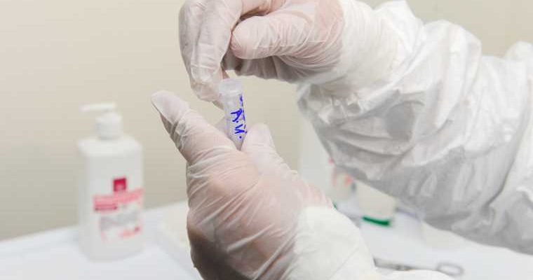 Челябинская область вылечили от коронавируса умер